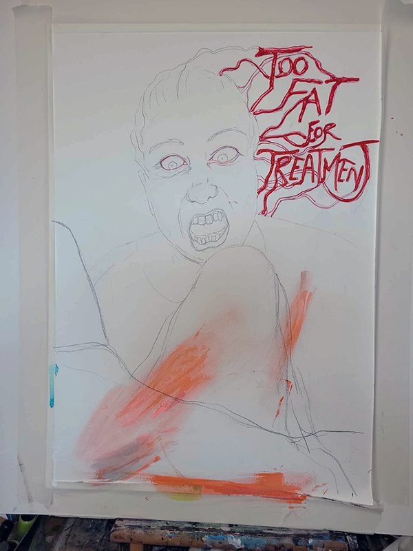 Too Fat for treatment 1722097248